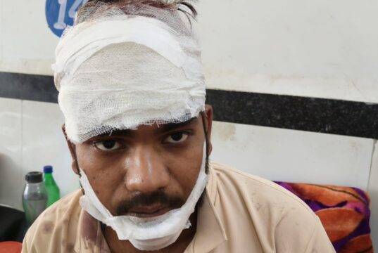 आपस में टकराई दो बाईक, युवक घायल
